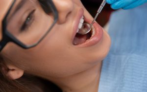 How Long Do Dental Sealants Last: What to Expect Over Time